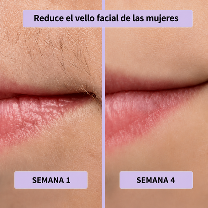 Sérum anti-vello Jovenella