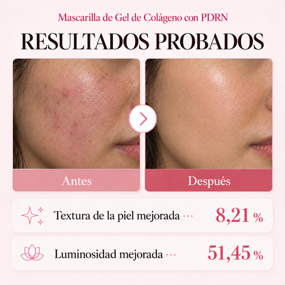 Resultados antes y después de la mascarilla de gel de colágeno con PDRN