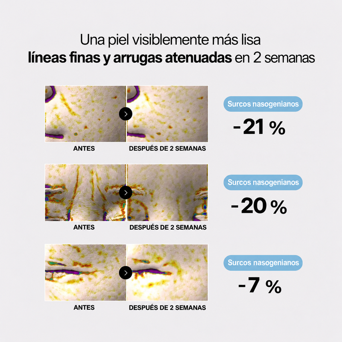 Líneas finas y arrugas atenuadas en 2 semanas