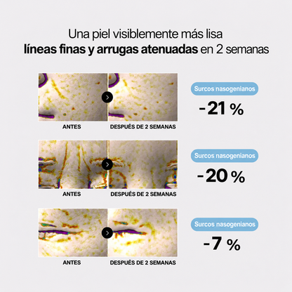 Líneas finas y arrugas atenuadas en 2 semanas
