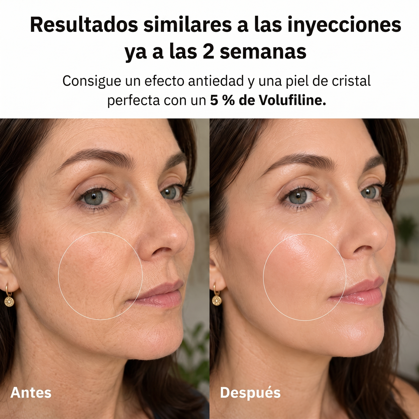Resultados similares a las inyecciones